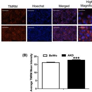 Mitochondrial Membrane Potentials Increased By Prkaa Knockdown In