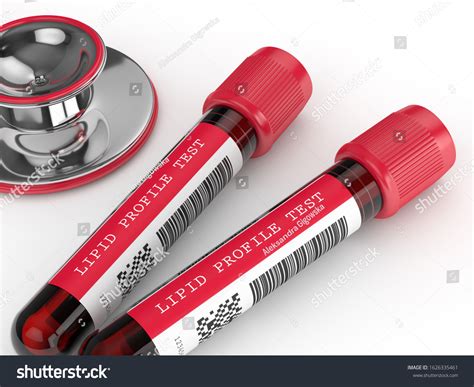 3d Render Lipid Profile Test Blood Stock Illustration 1626335461