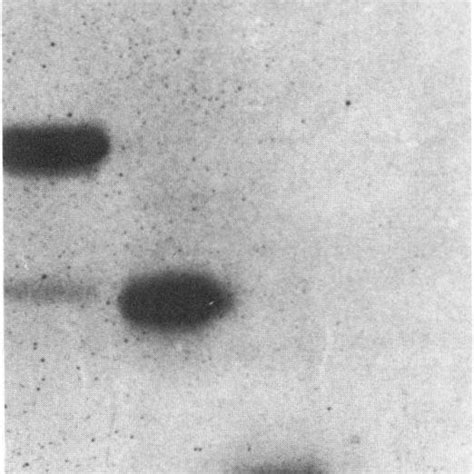 Sds Polyacrylamide Gel 5 20 Linear Gradient Of 72 Kd 1 50 Kd