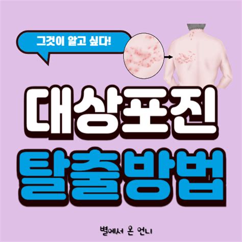 대상포진 초기증상과 치료방법