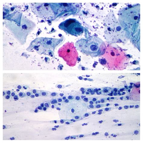 Make Your Diagnoses Cellnetpathology