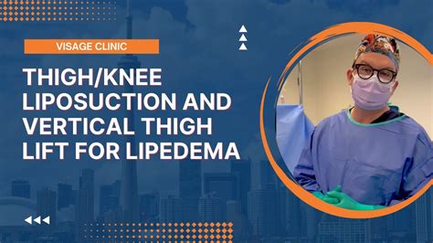 Thigh Knee Liposuction And Vertical Thigh Lift For Lipedema Visage