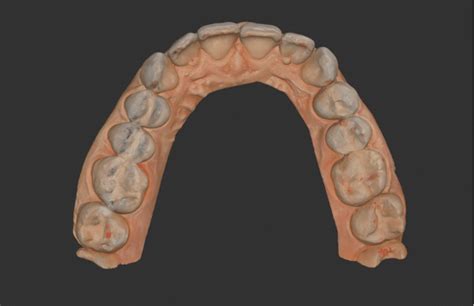 Upper Arch With Occlusal Markings Cad