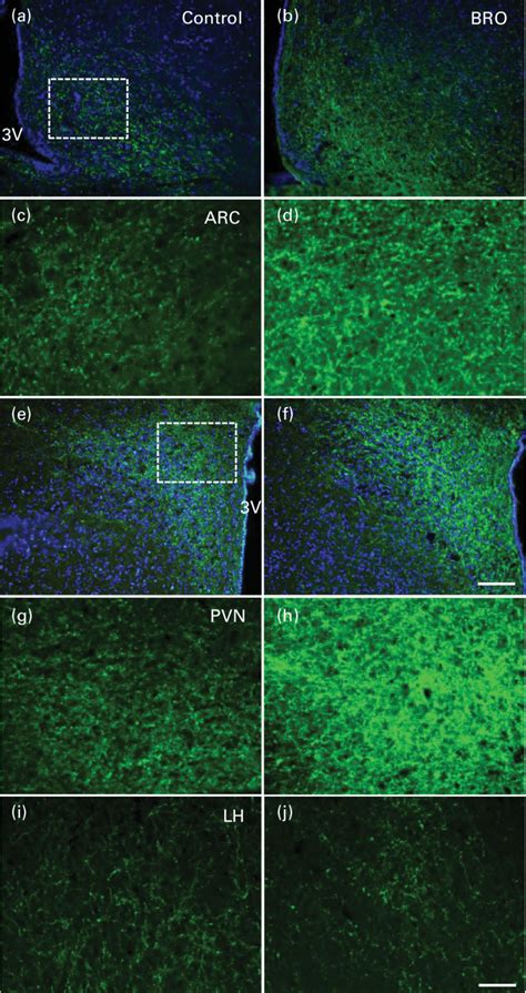 Immunohistochemistry Of Neuropeptide Y Npy In The Arcuate Nucleus