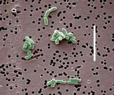 Brevibacterium linens - microbewiki