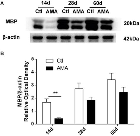 Effects Of AMA On MBP Protein Expression Levels In The Hippocampus In