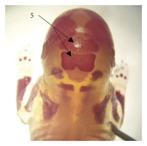 Alizarin red stained rat fetuses showing different ossification ... 