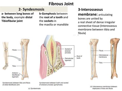 Articulation Joints Ppt Download