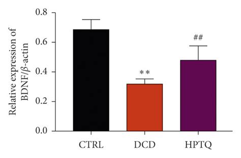 The Protein Levels Of P CREB BDNF TrkB And P Akt In Hippocampal