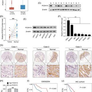 Pcdh Is Downregulated In Human Gastric Cancer Gc Cells Which Is