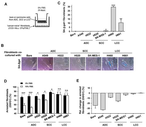 Analysis Of Senescence Markers In Normal Cancer Naive Lung