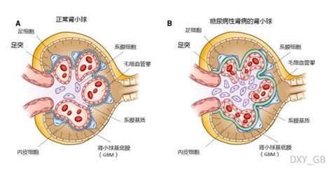 糖友尿中泡沫多？這是腎臟在發出緊訊！如何改善泡泡尿？ 每日頭條