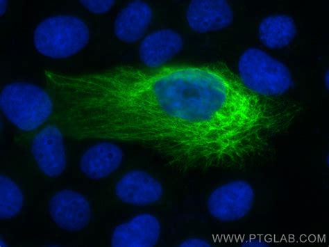 Cytokeratin Antibody Rr Proteintech