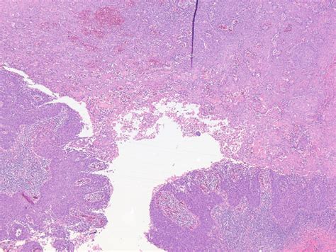 Bartholin Gland Histology