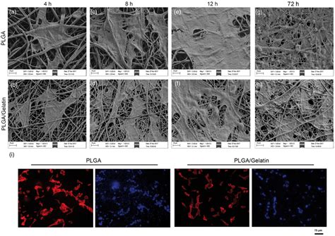 Electrospun PLGA And PLGA Gelatin Scaffolds For Tubularized Urethral