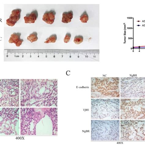 NgBR is required for TGF β1 induced cell migration and invasion of A549