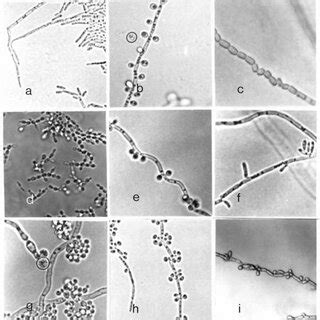 Morfología de diferentes especies de Candida a C krusei b C