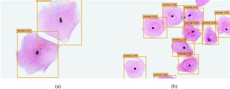 detection results  normal cells  scientific diagram
