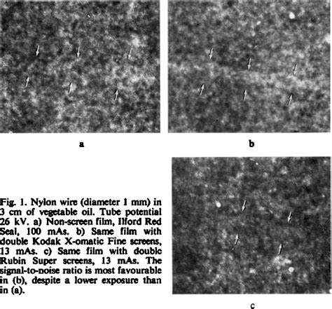 Figure 1 From Intensifying Screens In Soft Tissue Radiography Semantic Scholar