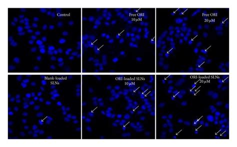 Apoptotic Morphology Of Mcf 7 Cells Treated With 20 μm And 10 μm Free