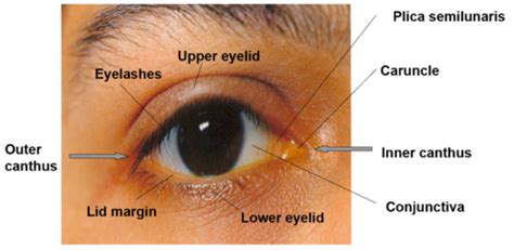 Eyelid Conjunctiva Flashcards Quizlet