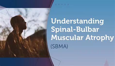 Understanding Spinal Bulbar Muscular Atrophy Sbma Mysmateam