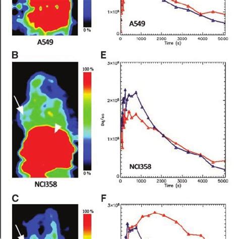 A, inhibition of proliferation by erlotinib in lung cancer cells. Cells... | Download Scientific ...