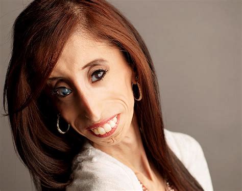 Lizzie Velasquez La Donna Pi Brutta Del Mondo Apriamo La Nostra