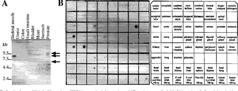 Figure 1 From Molecular Cloning And Characterization Of A Distinct