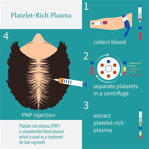 Platelet Rich Plasma Is A Newly Developed Process To Assisted Hair