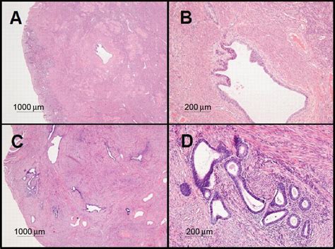 Photomocrographs Of Hematoxylin And Eosin Stained Uterine Tissue