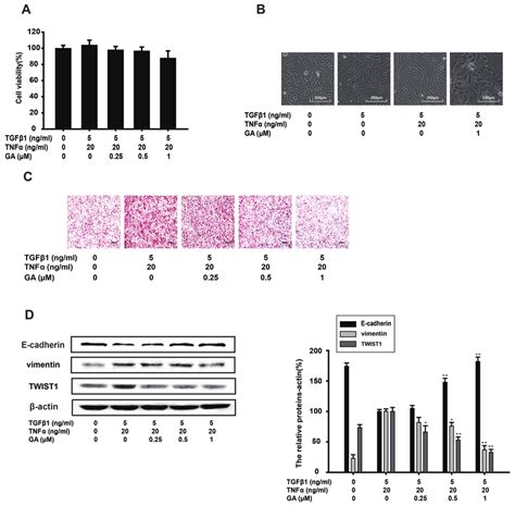 Ga Inhibits Tgf Tnf Induced Emt And The Invasion Of A Cells A