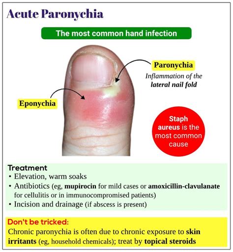 Acute Paronychia Medicine Keys For MRCPs