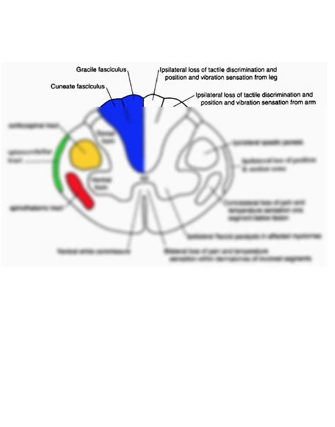 SOLUTION: Spinal cord schematic - Studypool