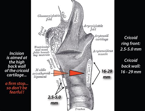 cricothyrotomy | Prehospital and Retrieval Medicine - THE PHARM ...