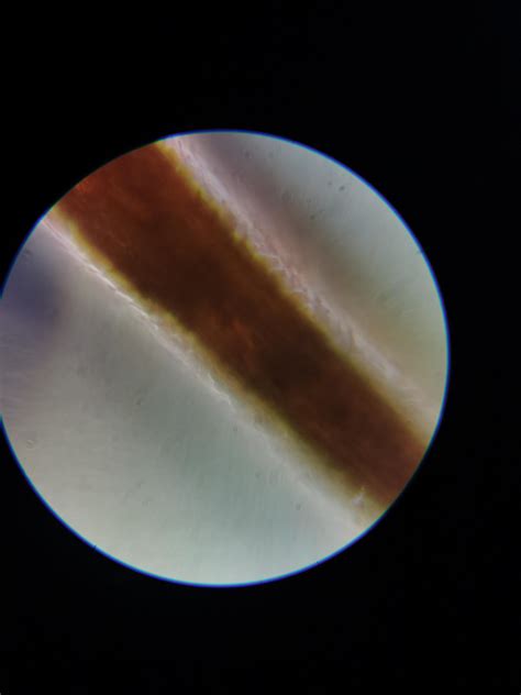 Yogurt Bacteria Compared To Human Hair 1000x Mag Rmicroscopy
