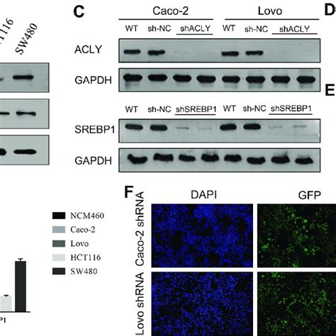 ACLY SREBP1 Knockdown Promoted Apoptosis In Colorectal Cancer Cells