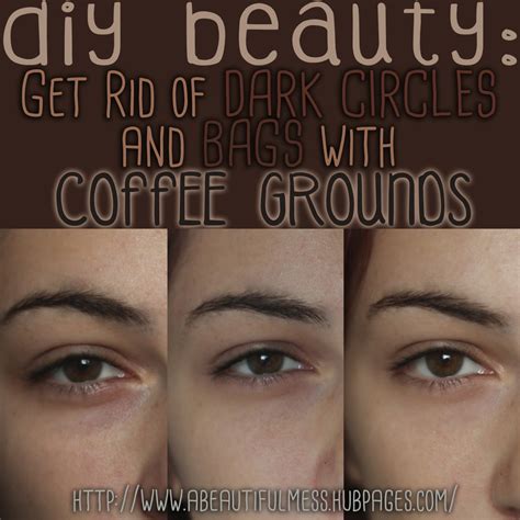 DIY Beauty Get Rid Of Undereye Bags And Dark Circles With Coffee