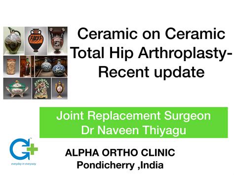 Ceramic On Ceramic In Total Hip Replacement Ppt Free Download