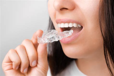 Invisalign Para Qu Sirven Los Ataches En La Ortodoncia Invisible