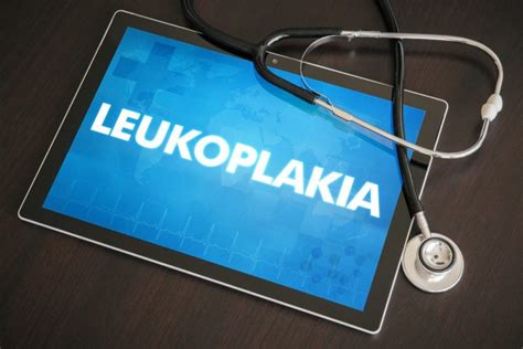 What is Leukoplakia? - Facty Health