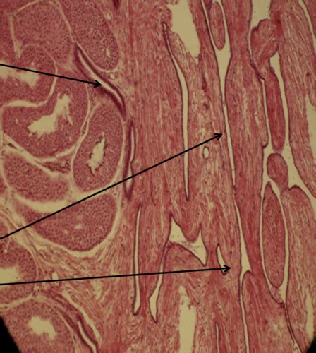 Male Repro Histology Flashcards Quizlet