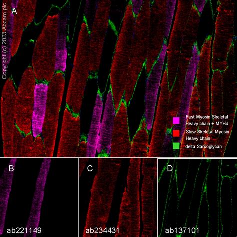 Anti Slow Skeletal Myosin Heavy Chain 抗体 Epr22697 17 Ab234431