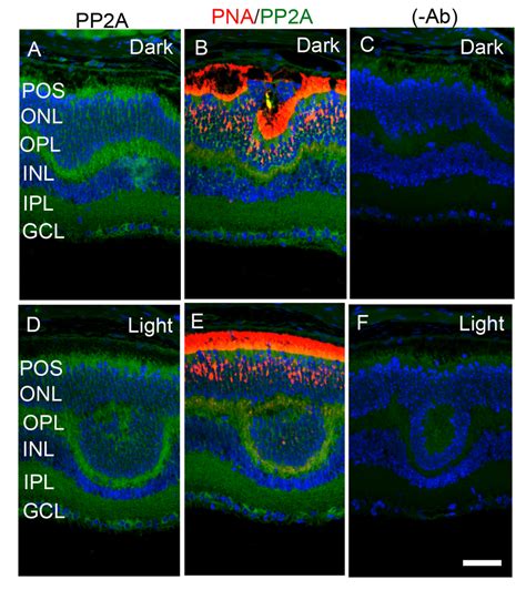 Immunofluorescence Analysis Of Pp2a In Cone Dominant Nrl Mouse Download Scientific Diagram