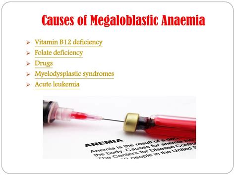 Ppt Megaloblastic Anaemia Symptoms Causes Diagnosis Treatment And Preventions Powerpoint