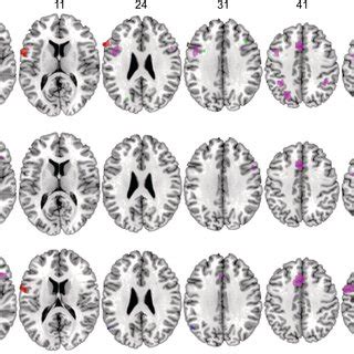 Brain Regions Showing Significant Common Activation Across Musical