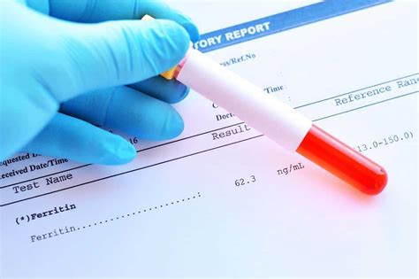 Ferritin Nedir Ferritin Eksikli I Neden Olur Ferritin Az Ve Y Ksek