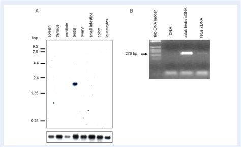 Expression Of Nanos In Human Tissues A Northern Blot Analysis Of