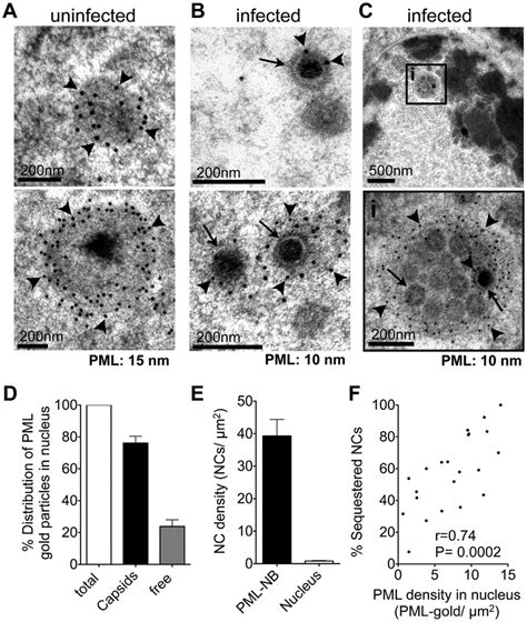 PML Cages Sequester Mature And Immature VZV Nucleocapsids A C