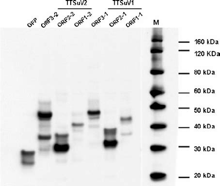 Western Blot Analysis Of Expressed Fused Ttsuv Proteins Using Anti Gfp